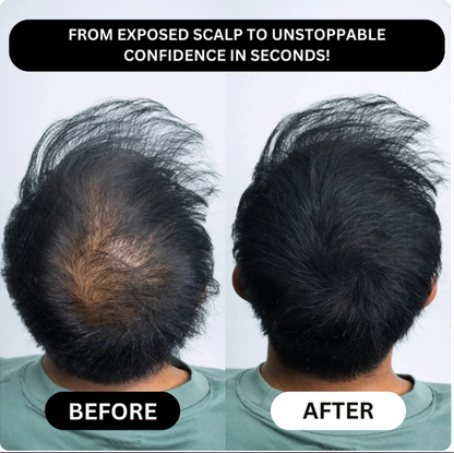 India’s #1 Fix for Thinning Hair — Instant, Natural Results